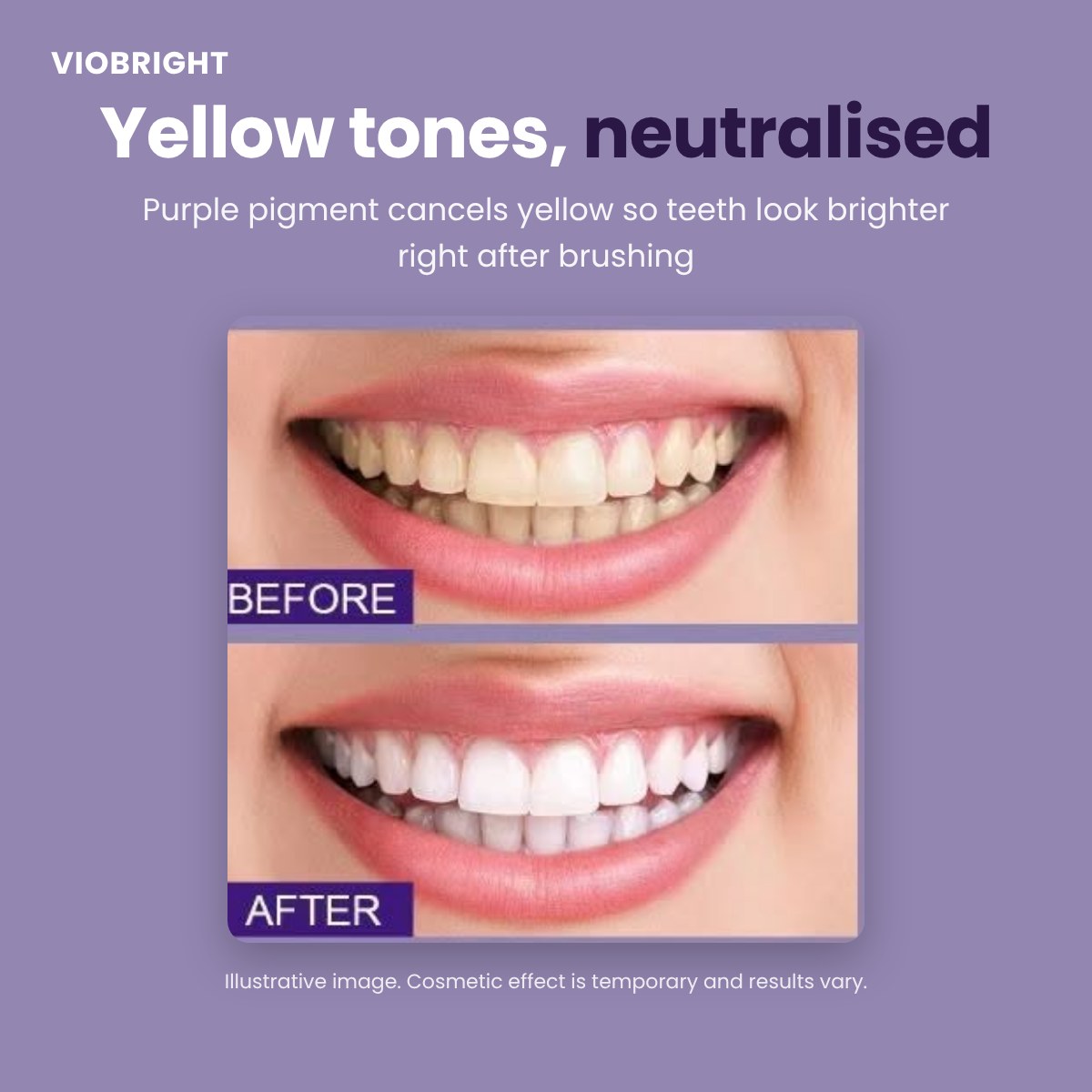 Before and after: yellow teeth look whiter after brushing with VioBright purple colour corrector toothpaste